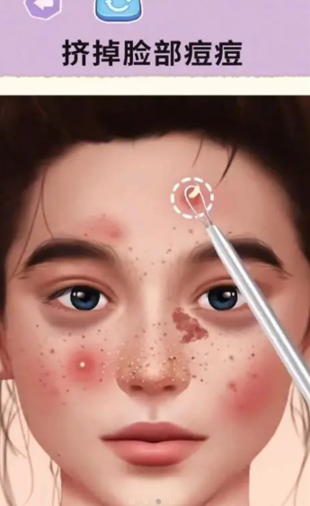 挤痘痘游戏哪些值得下载2026